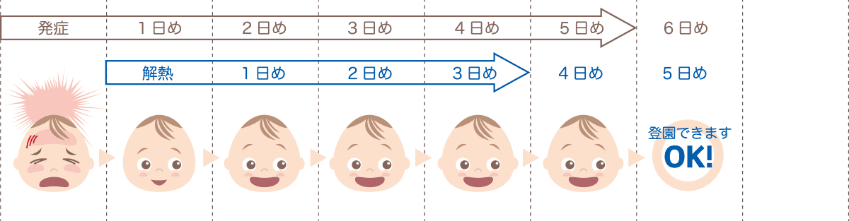 インフルエンザの出席停止期間の数え方