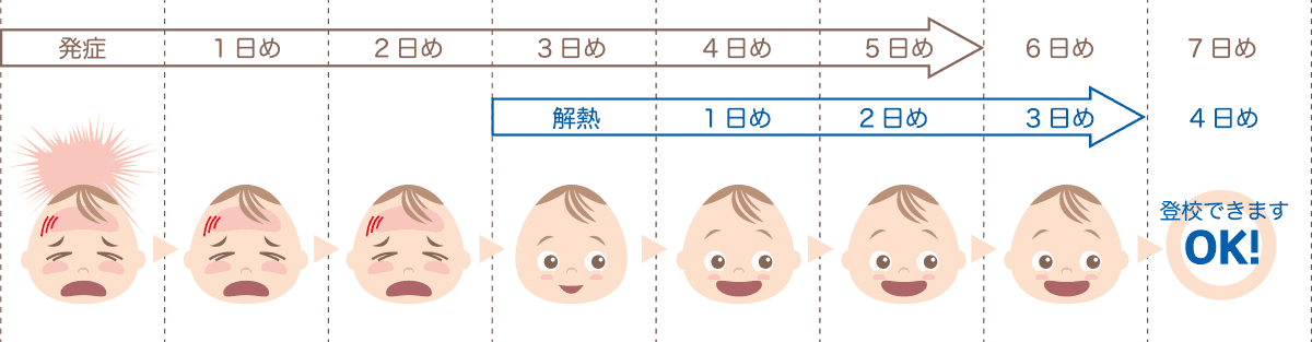 インフルエンザの出席停止期間の数え方