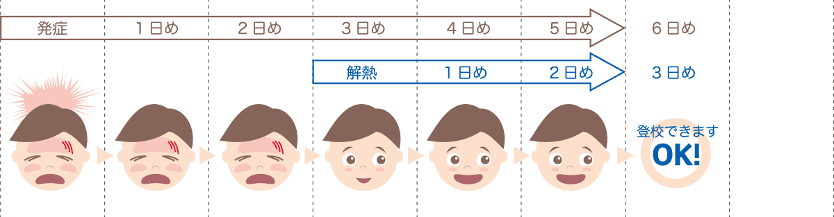 インフルエンザの出席停止期間の数え方