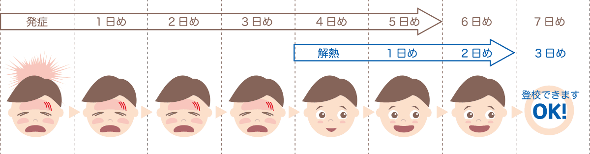 インフルエンザの出席停止期間の数え方